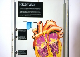 Pacemaker